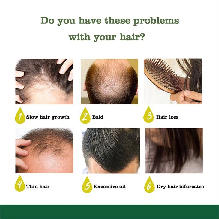 Herbal Ginger Hair Growth Care Oil Spray