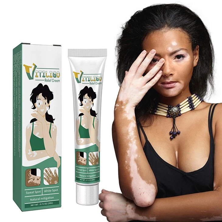 White Spot Removal Skin Vitiligo Cream
